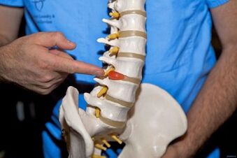 Zergatik min egiten du bizkarraldea beheko bizkarrean eta zer egin