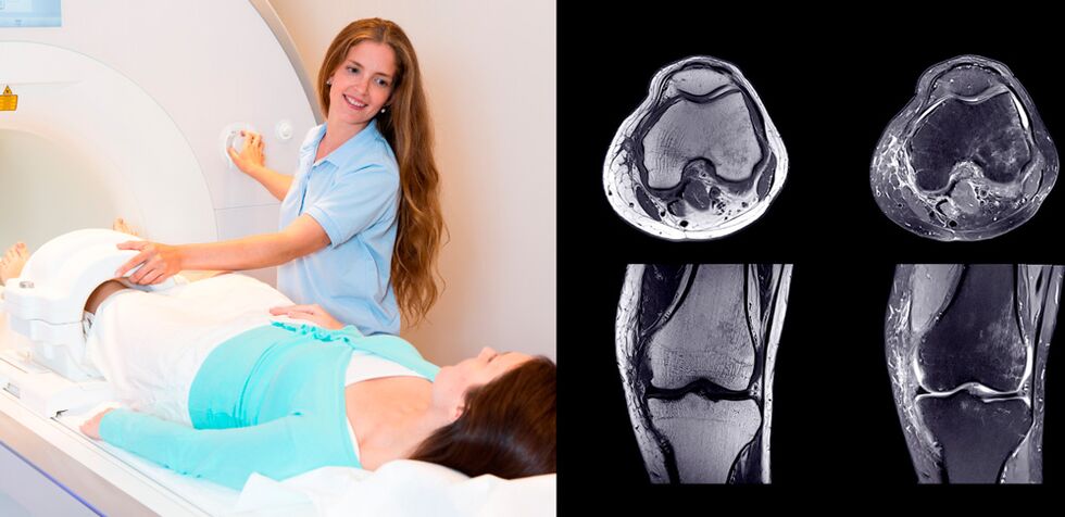 belauneko artikulazioen diagnostikoa