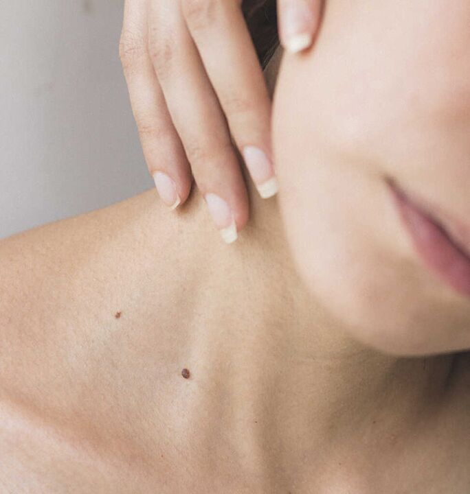 Lepoko zurruntasuna bizkarrezurreko osteokondrosiaren hasierako sintometako bat da.